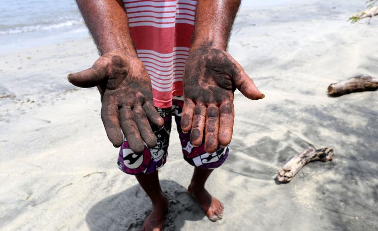 Coal dust washed up on the beach marks the hands of a local villager in Columbia. 