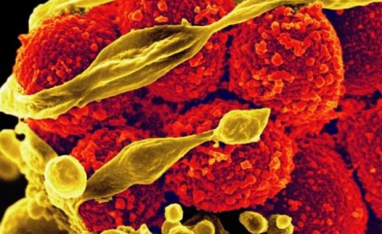 Scanning electron micrograph of methicillin-resistant Staphylococcus aureus bacteria (yellow, round items) killing and escaping from a human white cell. Photo: NIAID via Flickr (CC BY).