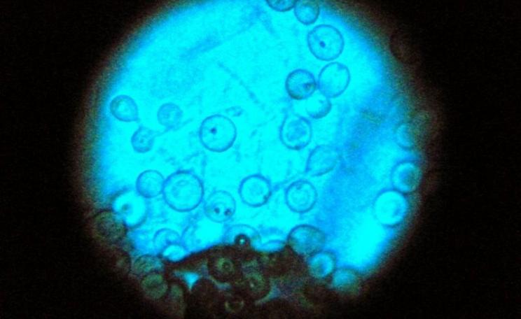 The soil fungus Aspergillus nidulans on lactophenol cotton blue wet preparation. Photo: Iqbal Osman via Flickr (CC BY).